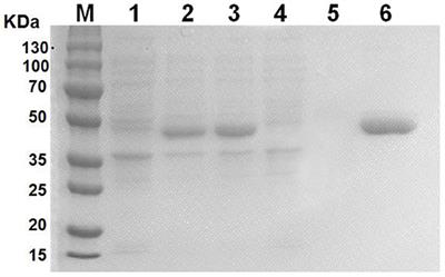 Effective Pro-Inflammatory Induced Activity of GALT, a Conserved Antigen in A. Pleuropneumoniae, Improves the Cytokines Secretion of Macrophage via p38, ERK1/2 and JNK MAPKs Signal Pathway